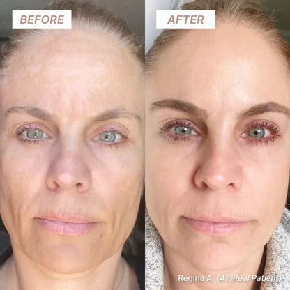 NAD Coenzyme & EGF Peptide Firming Serum