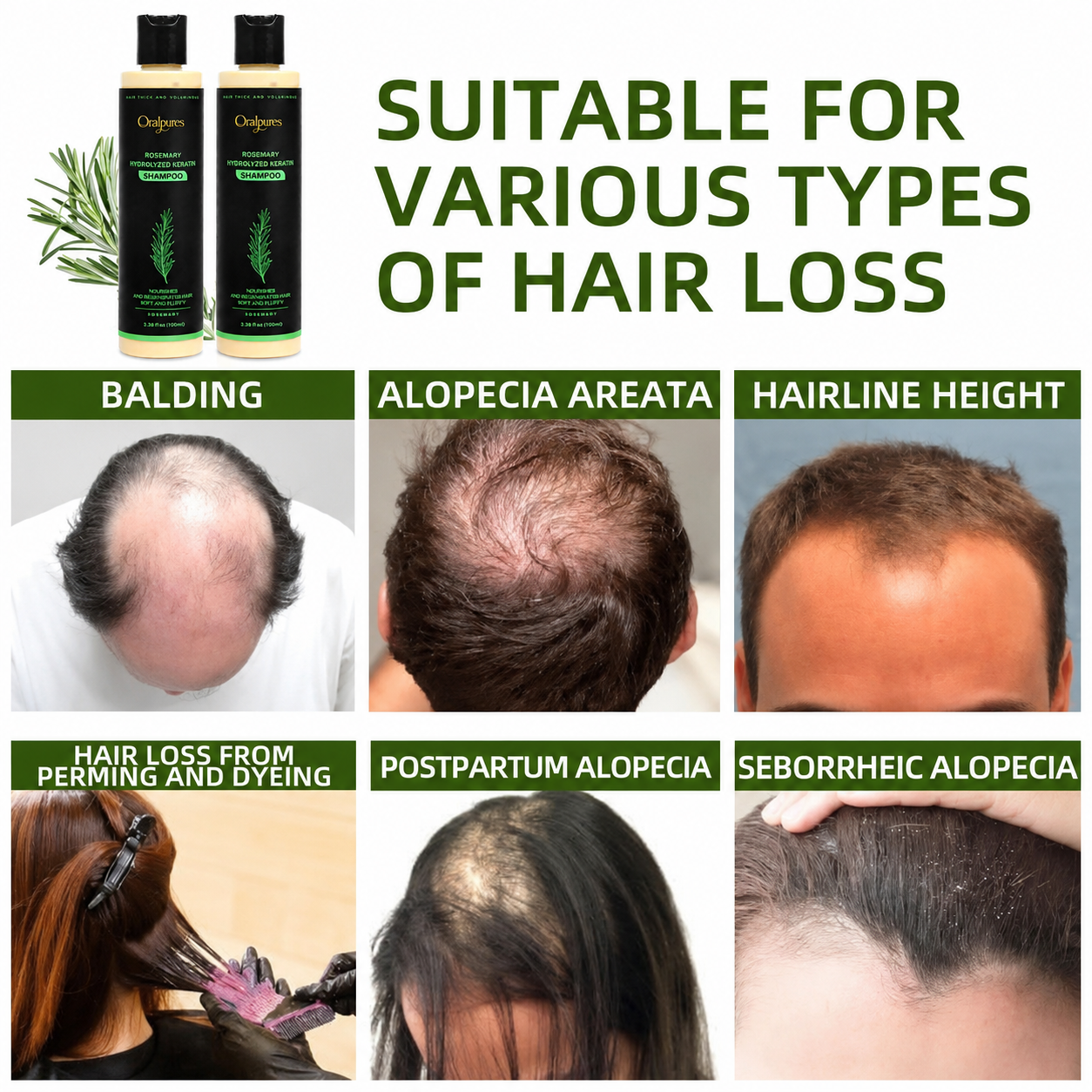 🔥LAST DAY 50% OFF - OralPures Organic Rosemary Hair Growth Shampoo