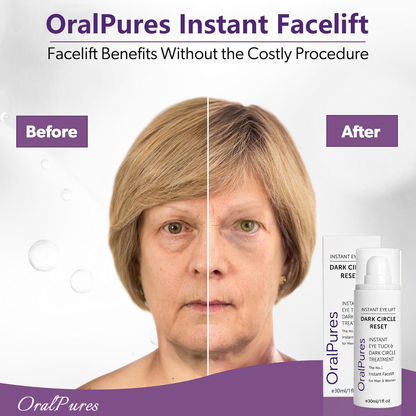 🔥LAST DAY 60% OFF OralPures miracle peptide Instant Facelift Anti Aging Eye Serum