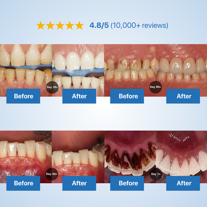 Oralpures Tooth Repairing Powder