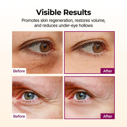 OralPures™ Calcium Volume Multi Balm Eye Care Routine Korean Skin Care Anti-aging Cosmetics Collagen Eye Stick