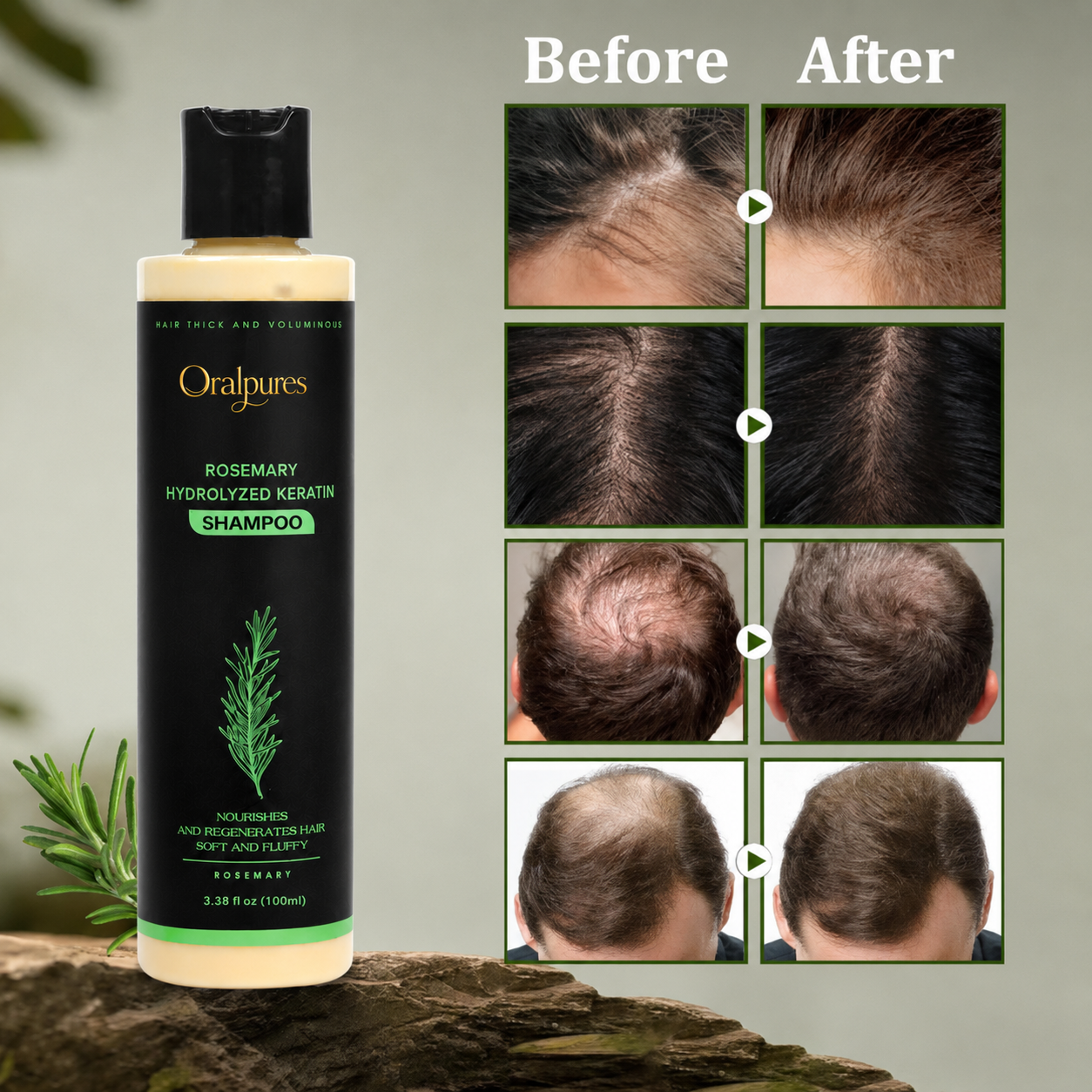 🔥LAST DAY 50% OFF - OralPures Organic Rosemary Hair Growth Shampoo