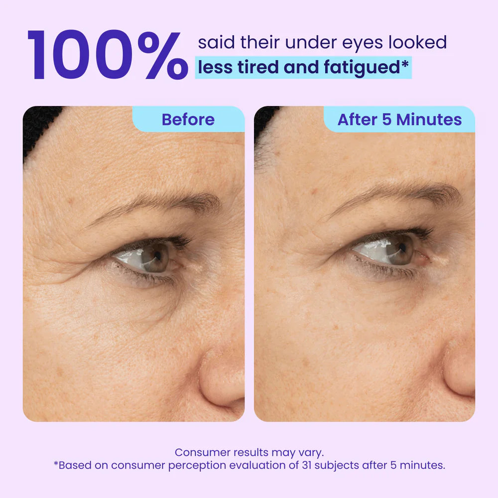 OralPures™ Instant Lift Eye Gel