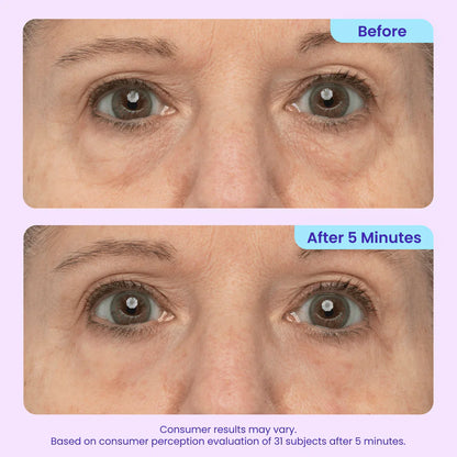 OralPures™ Instant Lift Eye Gel