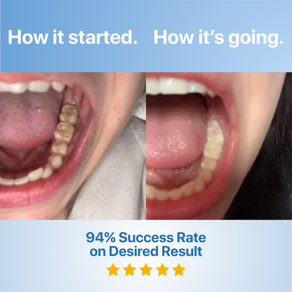 Oralpures Tooth Repairing Powder