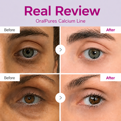 🔥LAST DAY 60% OFF!!OralPures Korean Calcium Dark Spot Eye Cream